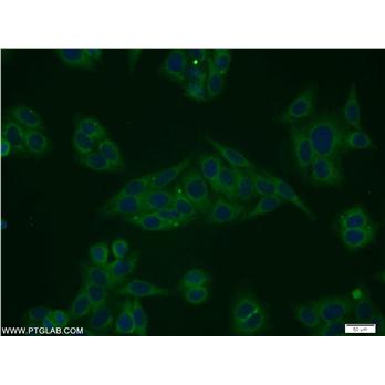STARD5 Rabbit Polyclonal Antibody (10487-1-AP)