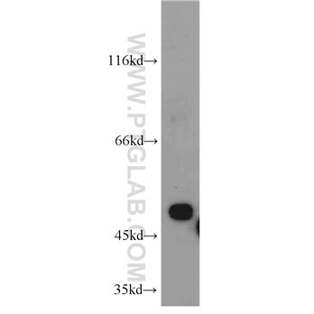 EIF2S2 Rabbit Polyclonal Antibody (10227-1-AP)