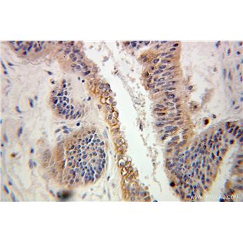 ARL2 Rabbit Polyclonal Antibody (10232-1-AP)