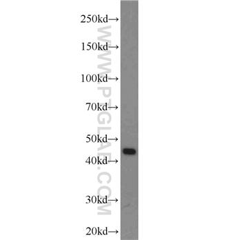 PREB Rabbit Polyclonal Antibody (10146-2-AP)