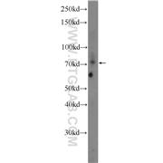 AKAP8L Rabbit Polyclonal Antibody (10103-1-AP)