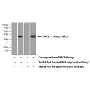 RFC5 Rabbit Polyclonal Antibody (10385-1-AP)