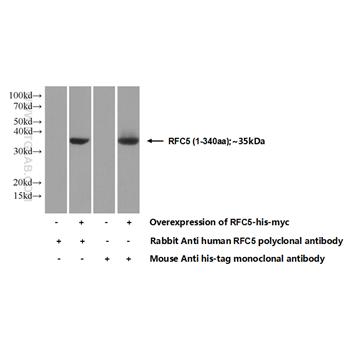 RFC5 Rabbit Polyclonal Antibody (10385-1-AP)