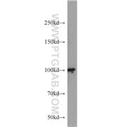 DDX23 Rabbit Polyclonal Antibody (10199-2-AP)