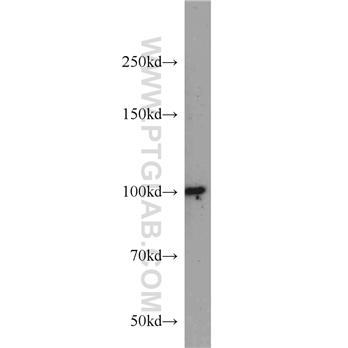 DDX23 Rabbit Polyclonal Antibody (10199-2-AP)
