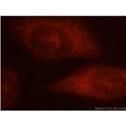 ALOX5 Rabbit Polyclonal Antibody (10021-1-Ig)