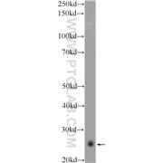 SERTAD1 Rabbit Polyclonal Antibody (10167-1-AP)