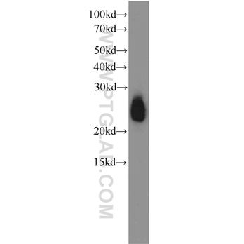APOD Rabbit Polyclonal Antibody (10520-1-AP)