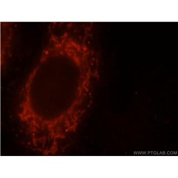 YY1AP1 Rabbit Polyclonal Antibody (10425-1-AP)