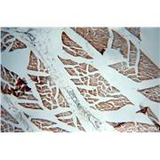 VAMP2 Rabbit Polyclonal Antibody (10135-1-AP)