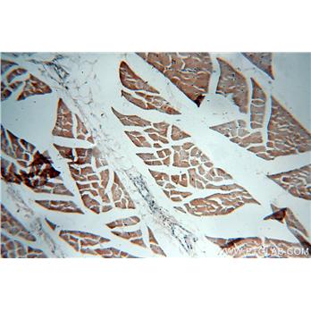 VAMP2 Rabbit Polyclonal Antibody (10135-1-AP)