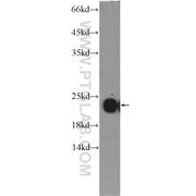 PRDX2 Rabbit Polyclonal Antibody (10545-2-AP)