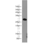 COMMD5 Rabbit Polyclonal Antibody (10393-1-AP)
