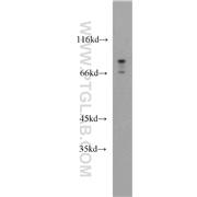 MLPH Rabbit Polyclonal Antibody (10338-1-AP)