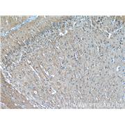 TUBB3 Rabbit Polyclonal Antibody (10068-1-AP)