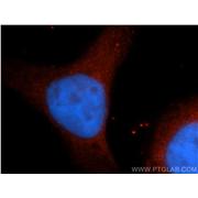 NUMBL Rabbit Polyclonal Antibody (10111-1-AP)
