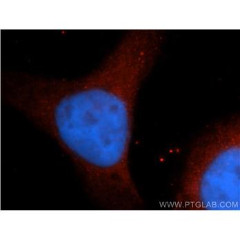 NUMBL Rabbit Polyclonal Antibody (10111-1-AP)