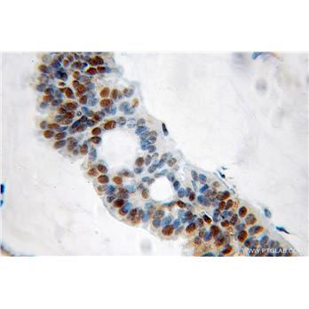 GNL2 Rabbit Polyclonal Antibody (10190-2-AP)