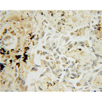 UBE2I Rabbit Polyclonal Antibody (10070-1-AP)