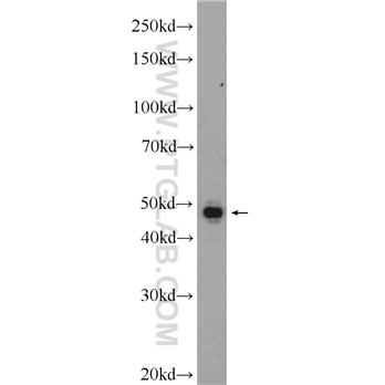 CTSH Rabbit Polyclonal Antibody (10315-1-AP)