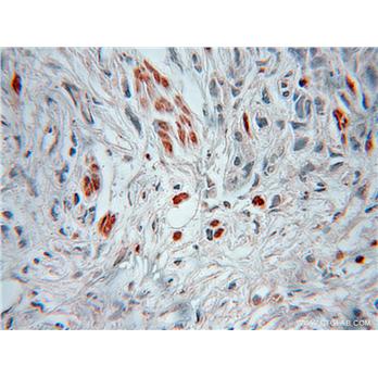 HSBP1 Rabbit Polyclonal Antibody (10169-2-AP)