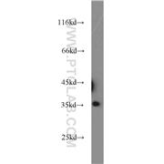 PPP4C Rabbit Polyclonal Antibody (10262-1-AP)