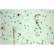 JUNB Rabbit Polyclonal Antibody (10486-1-AP)