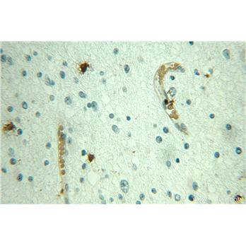 JUNB Rabbit Polyclonal Antibody (10486-1-AP)