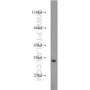PEF1 Rabbit Polyclonal Antibody (10151-1-AP)
