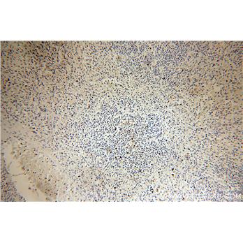 CD82 Rabbit Polyclonal Antibody (10248-1-AP)
