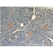 PCMT1 Rabbit Polyclonal Antibody (10519-1-AP)