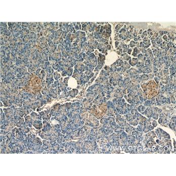 PCMT1 Rabbit Polyclonal Antibody (10519-1-AP)