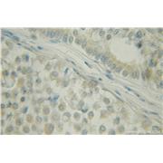 DCTN5 Rabbit Polyclonal Antibody (10182-1-AP)