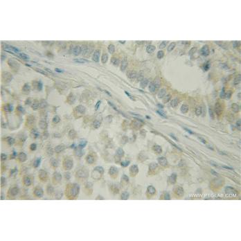 DCTN5 Rabbit Polyclonal Antibody (10182-1-AP)