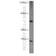 CFLAR Rabbit Polyclonal Antibody (10394-1-AP)