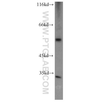 CFLAR Rabbit Polyclonal Antibody (10394-1-AP)