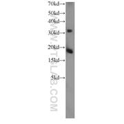 TSC22D1 Rabbit Polyclonal Antibody (10214-1-Ig)