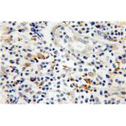 MMP9 Rabbit Polyclonal Antibody (10375-2-AP)