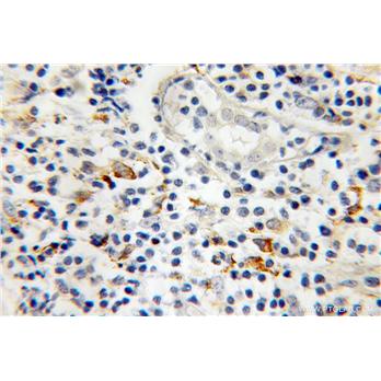 MMP9 Rabbit Polyclonal Antibody (10375-2-AP)