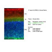 ARRB2 Rabbit Polyclonal Antibody (10171-1-AP)