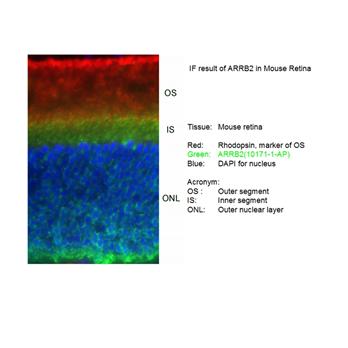 ARRB2 Rabbit Polyclonal Antibody (10171-1-AP)
