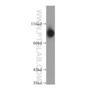 DIDO1 Rabbit Polyclonal Antibody (10183-1-AP)