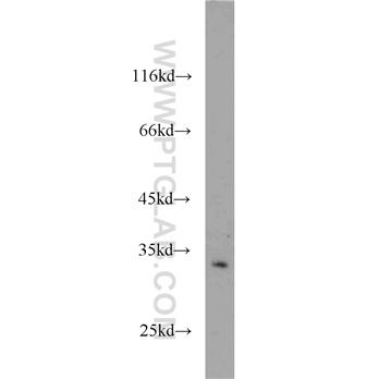 CDK5 Rabbit Polyclonal Antibody (10430-1-AP)