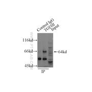 TGFBI Rabbit Polyclonal Antibody (10188-1-AP)