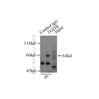 TGFBI Rabbit Polyclonal Antibody (10188-1-AP)