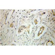 GSTA2 Rabbit Polyclonal Antibody (10505-1-AP)