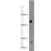 ZYX Rabbit Polyclonal Antibody (10330-1-AP)