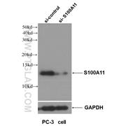 S100A11 Rabbit Polyclonal Antibody (10237-1-AP)