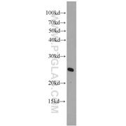ARL4A Rabbit Polyclonal Antibody (10312-1-AP)