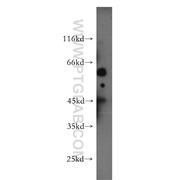HERPUD1 Rabbit Polyclonal Antibody (10813-1-AP)